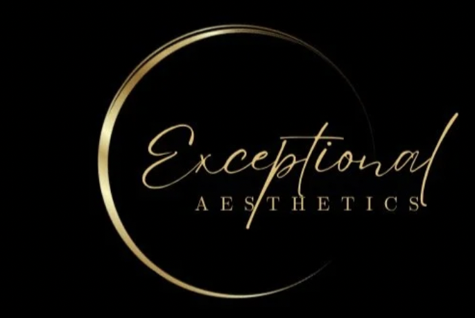 Exceptional